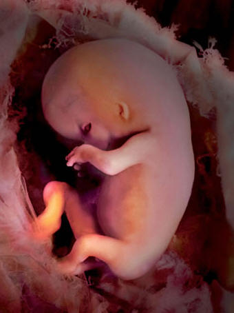 foetus